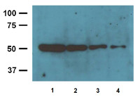 Beta-tubulin, (loading control antibody), mouse monoclonal in the group Antibodies Human Cell Biology / Human Developmental Biology at Agrisera AB (Antibodies for research) (AS20 4382)